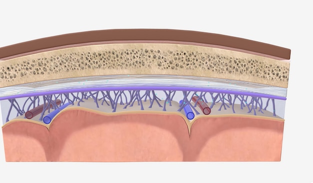 A diminuição da pressão intracraniana