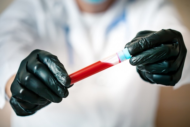 A epidemia de coronavírus. Mão de um médico segurando uma garrafa de amostra de sangue.