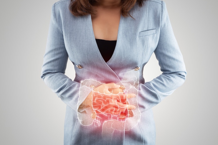 A ilustração do intestino grosso está no corpo da mulher. Mulher de negócios tocando a barriga dolorosa, sofrendo de enterite. órgãos internos do corpo humano. doença inflamatória intestinal