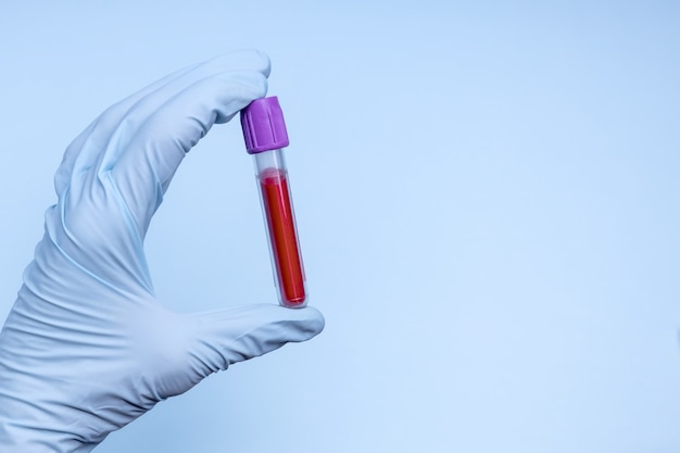 A mão de uma mulher segura um tubo de ensaio com sangue
