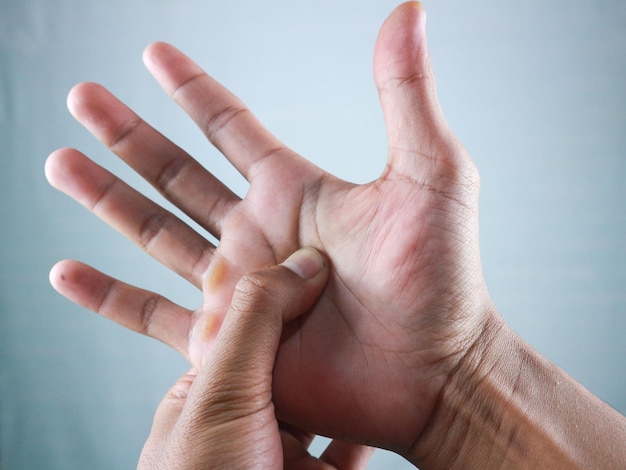 A mão do homem pressionando o ponto de acupressão na mão que sente dor e dor do trabalho