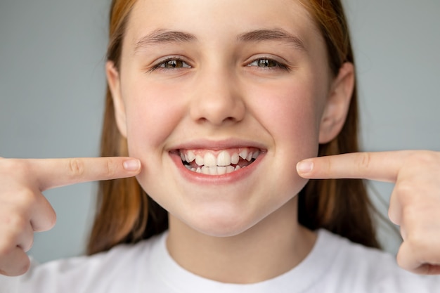 A menina sorri e mostra os dentes desiguais com as mãos remédios odontológicos e saúde