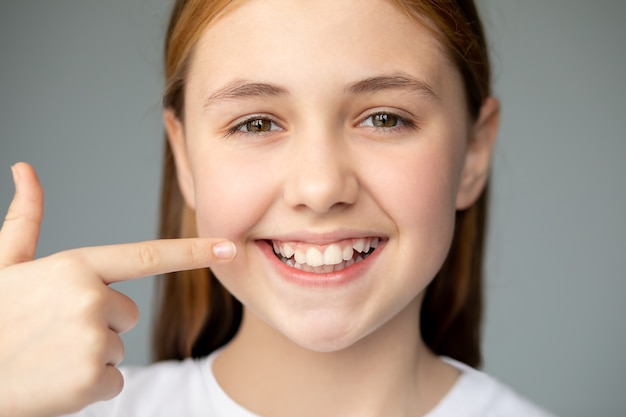 A menina sorri e mostra seus dentes desiguais com um remédio odontológico para dedo e saúde