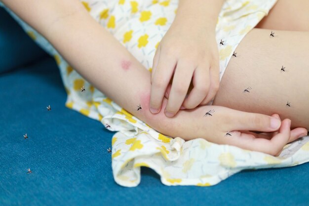 A menina tem alergia a erupções cutâneas e comichão no braço por picada de mosquito.