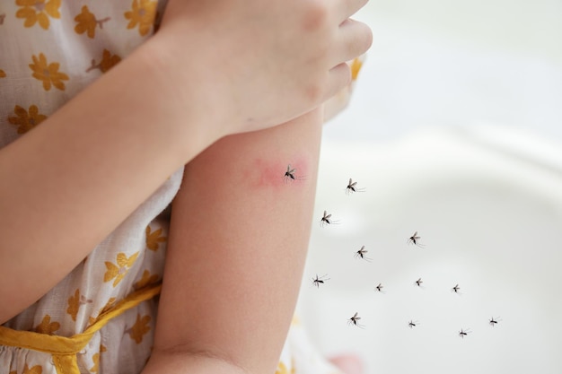 A menina tem alergia a erupções cutâneas e comichão no braço por picada de mosquito.