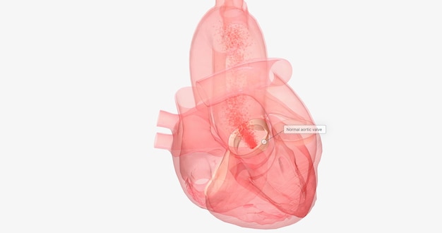 A válvula aórtica está entre o ventrículo esquerdo do coração e a aorta, a maior artéria do corpo