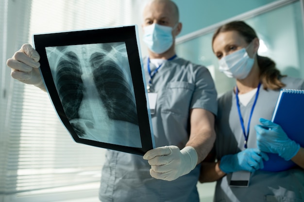 Abaixo, a imagem de um cirurgião atencioso de uniforme e luvas discutindo a imagem de raio-x do pulmão com o assistente antes da operação