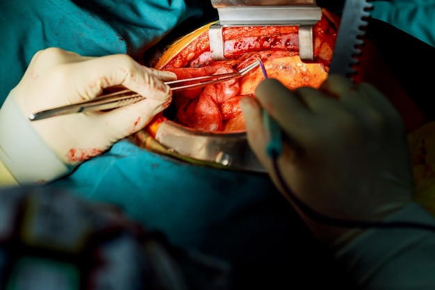 Abgeschnittene Hände eines Arztes, der einen Patienten im Operationssaal operiert