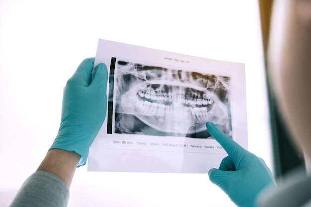 Abgeschnittene Hände eines Arztes, der im Krankenhaus Röntgenstrahlen analysiert