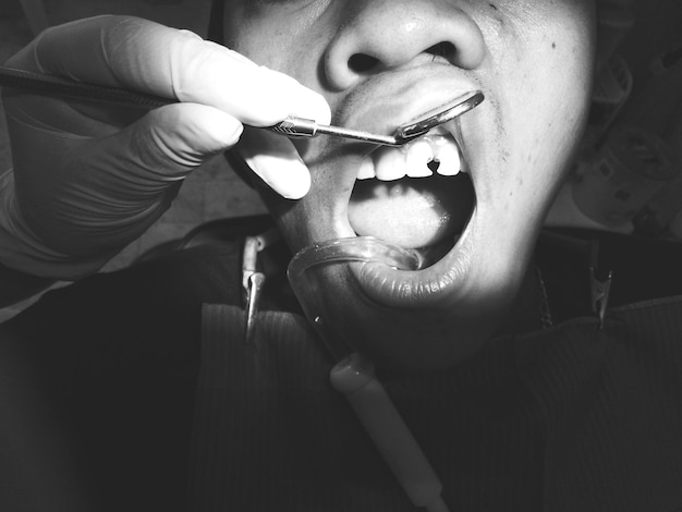 Foto abgeschnittene hand eines zahnarztes, der in einer klinik die zähne eines patienten operiert