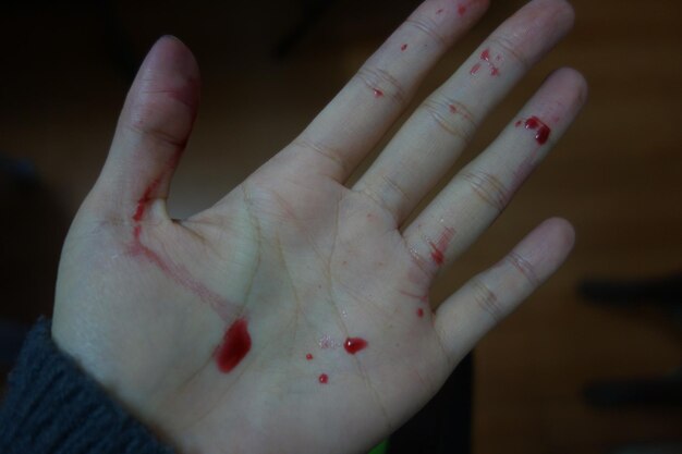 Abgeschnittenes Bild einer Hand mit Blut