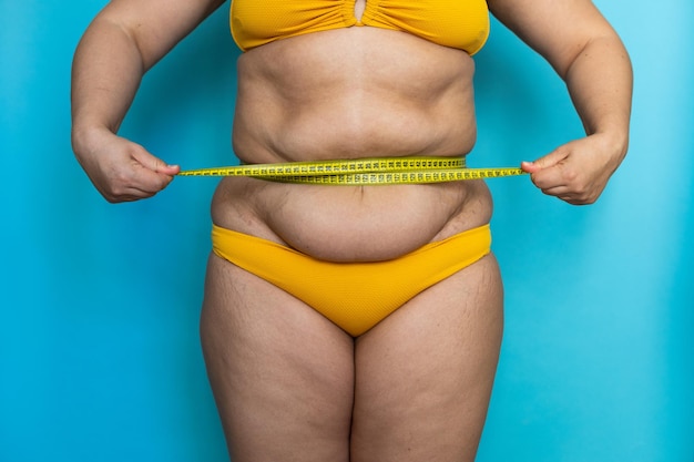 Abgeschnittenes Foto einer dicken Frau, die in gelben Badehosen steht und einen übermäßigen nackten Bauch zeigt, der die Taille mit Klebeband strafft