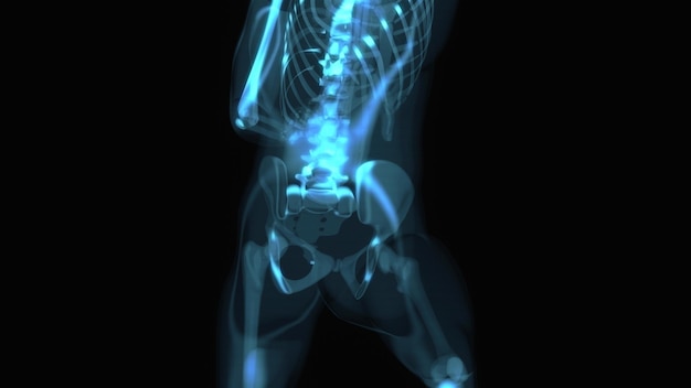 Abstraktes 3D-Motion-Design von Rückenschmerzen
