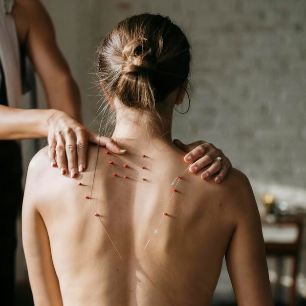 Foto acupuntura de espalda de una mujer.