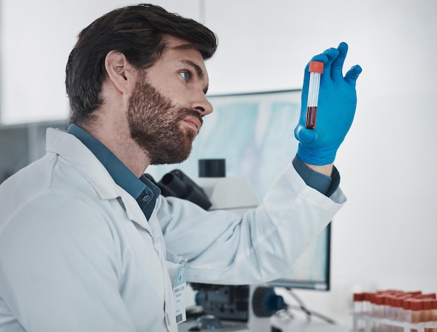 Foto adn científico y muestra con un médico trabajando en un laboratorio para análisis o investigación innovación médica y sangre con un científico masculino trabajando en un laboratorio para desarrollo o avance