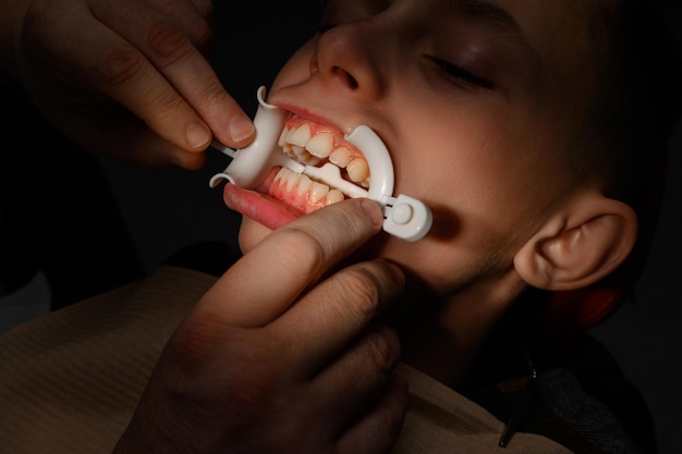 Afastador plástico para aumento labial no procedimento odontológico bucal e afastador como elemento auxiliar