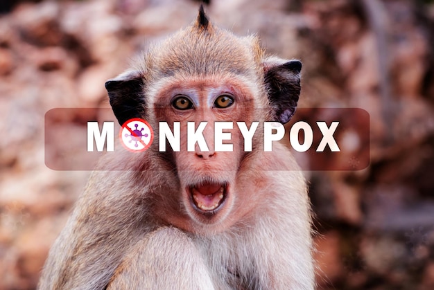 Affenpocken-Ausbruchskonzept Affenpocken werden durch das Affenpockenvirus verursacht Affenpocken sind eine virale Zoonose