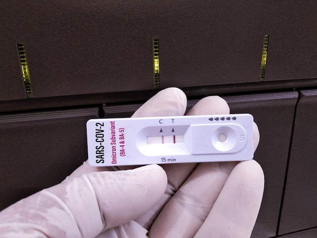 Affenpockenvirus-Antigentest durch Schnelltestkassette im medizinischen Labor. Ergebnis positiv anzeigen