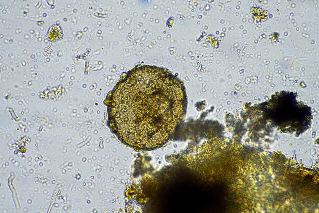 Agronom mit einer Bodenprobe mit Bodenleben und Insekten, Mikroorganismen, die Kohlenstoff speichern, mit Pilzen und Bakterien aus einem Bauernhof