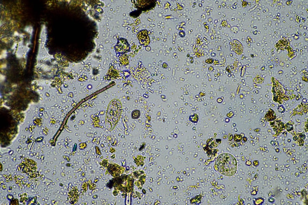 agrónomo con una muestra de suelo con vida del suelo y microorganismos bichos que almacenan carbono con hongos y bacterias de una granja