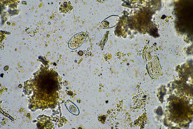 agrónomo con una muestra de suelo con vida del suelo y microorganismos bichos que almacenan carbono con hongos y bacterias de una granja