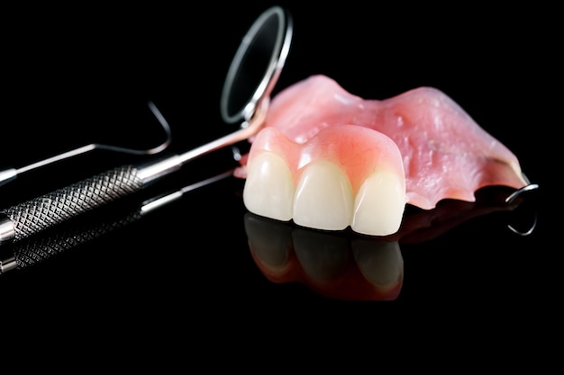 Aislante protésico dental - parte superior de la prótesis parcial.