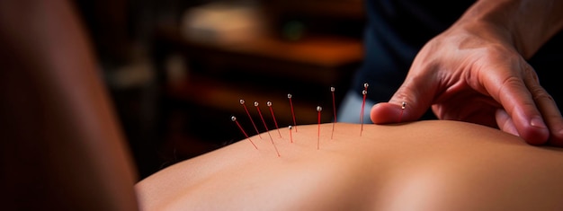 Akupunktur Rücken Hals Spa Salon Generative KI Menschen