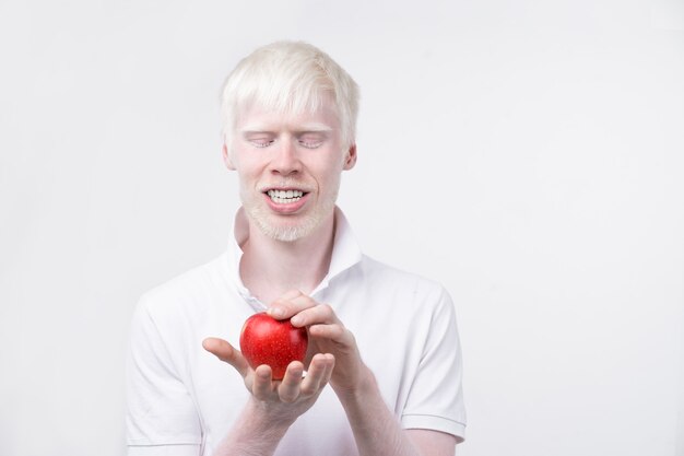 Albinismo homem albino em estúdio vestido de camiseta isolada em um fundo branco. desvios anormais. aparência incomum. anormalidade da pele