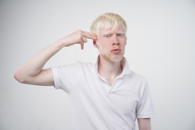 Albinismo homem albino em estúdio vestido de camiseta isolada em um fundo branco. desvios anormais. aparência incomum