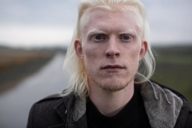 Albino cara fica em uma estrada rural