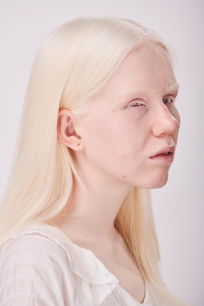 Albino-Frau mit ungewöhnlichem Aussehen