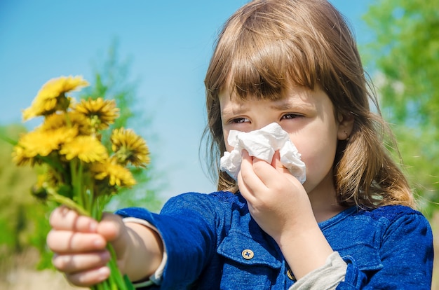 Foto alergia estacional en un niño