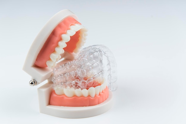 Foto alineadores invisibles y extraíbles para la alineación de los dientes