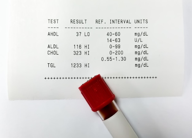 Amostra de sangue isolada para teste de perfil lipídico com relatório anormal