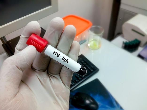 Amostra de sangue para anticorpo transglutaminase tecidual ou tTG IgA para o diagnóstico de doença celíaca