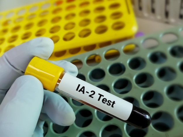 Amostra de sangue para Islet Antigen-2 (IA-2). Anticorpo das ilhotas pancreáticas