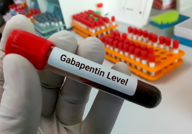 Amostra de sangue para teste de gabapentina definir a dose terapêutica para epilepsia ou convulsões