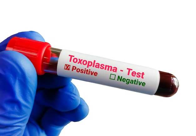 Foto amostra de sangue para teste de toxoplasma