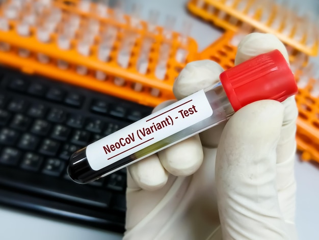 Amostra de sangue para teste de variante NeoCov