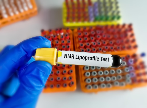 Amostra de sangue para teste nmr lipoprofile.