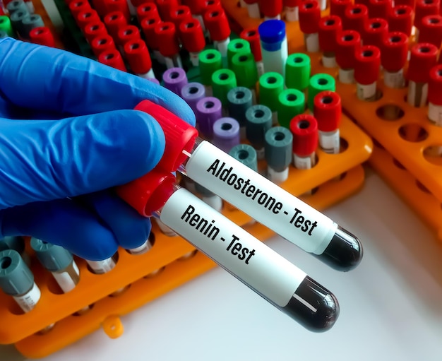 Amostras de sangue para teste de aldosterona e renina