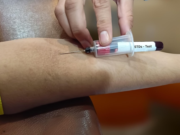 Amostras de sangue para teste de ferritina teste de monitoramento de pacientes com coronavírus Cuidados de saúde e conceito médico