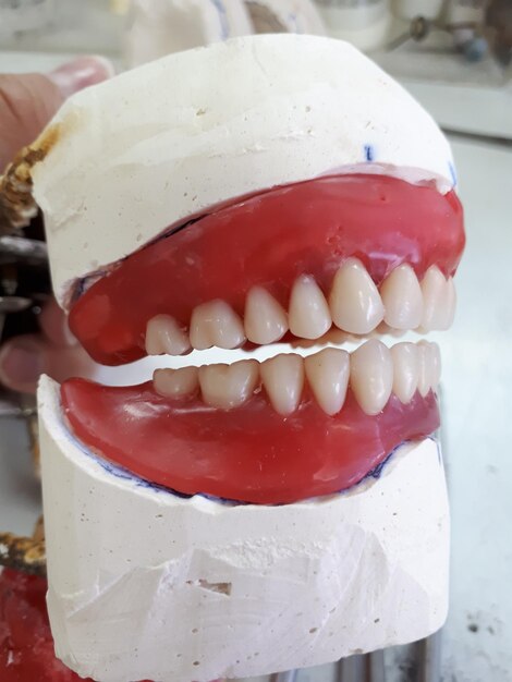 Foto amplo plano do modelo de dentes