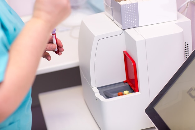 Analisador de sangue. Assistente de laboratório em laboratório médico mantém tubo de ensaio com sangue e plasma na mão e fazendo análises.