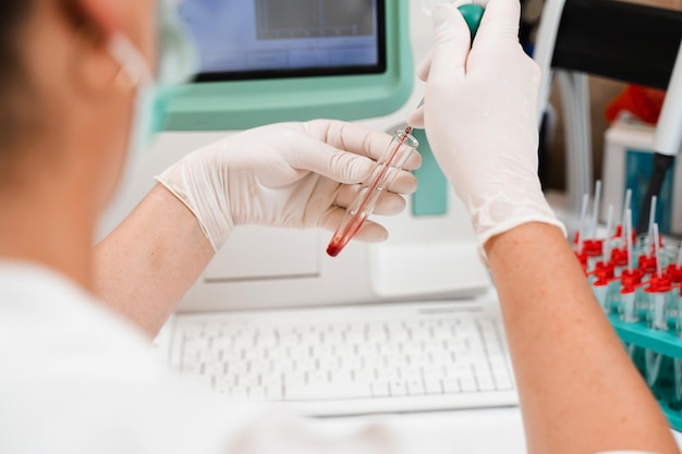 Foto análise de sangue no analisador em laboratório o assistente de laboratório faz análise hematológica equipamento médico no laboratório análise bioquímica e hematológica do sangue