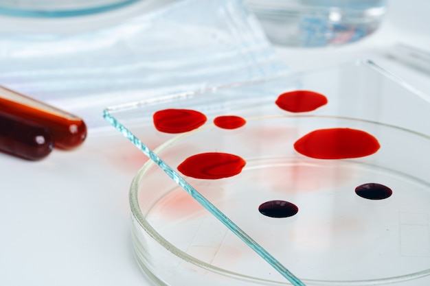 Análise de teste de sangue com placa de Petri close-up