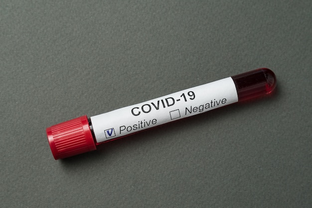 Análisis de sangre de coronavirus en gris. Resultado positivo de la prueba Covid-19.