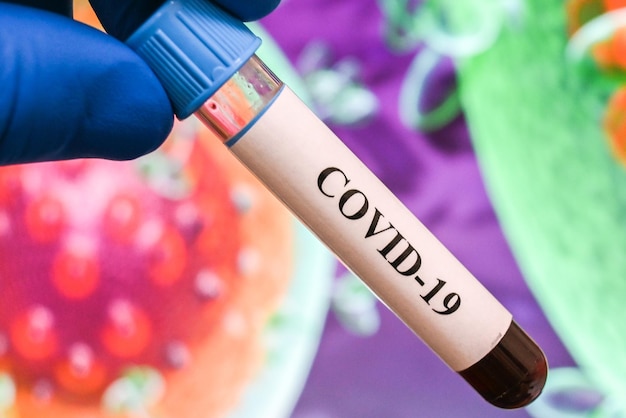 Análisis de sangre para el coronavirus que causa COVID19
