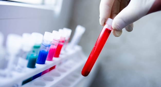 Foto análisis de sangre en un tubo de ensayo en el laboratorio