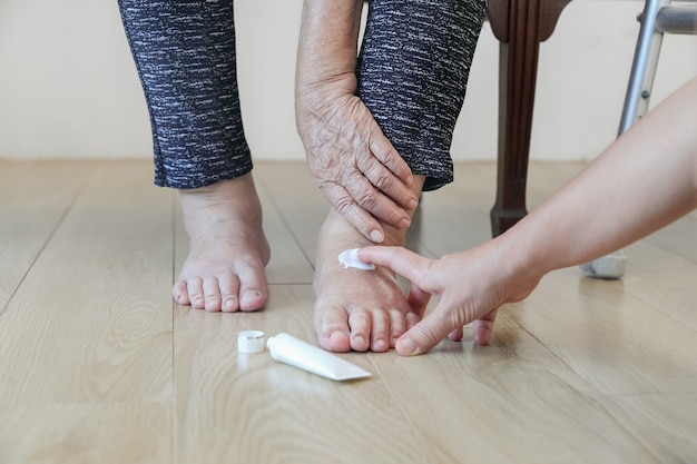 Anciana poniendo crema en los pies hinchados